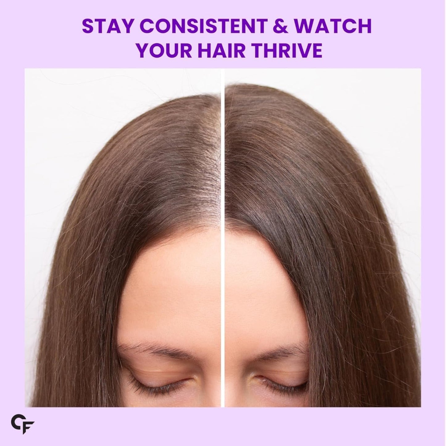 Carbamide Forte Biotin Tablets for Hair Growth with Amla, Brahmi & Bamboo Extract | Hair Growth Tablet | Hair Vitamins | Hair Supplements for Women & Men - 90 Veg Tablet