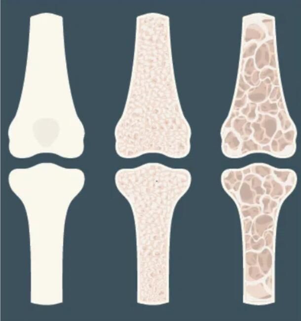 What Does Type X Collagen Do for Bone and Cartilage? - Carbamide Forte