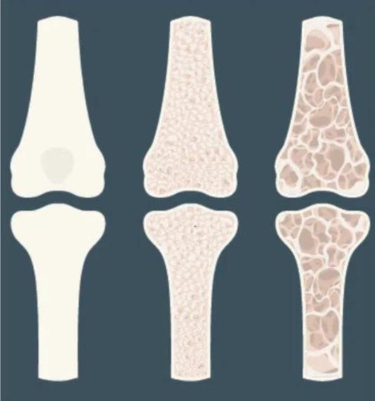What Does Type X Collagen Do for Bone and Cartilage? - Carbamide Forte