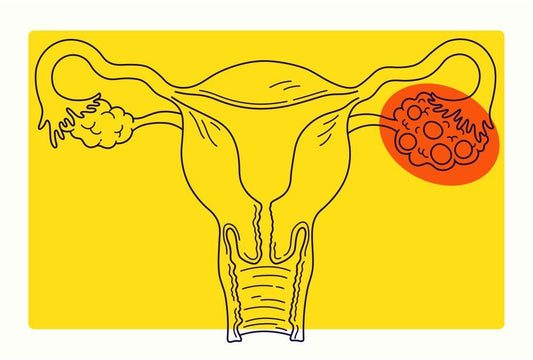 What Is the 40:1 Myo-Inositol to D-Chiro-Inositol Ratio and Why Does It Matter for PCOS?