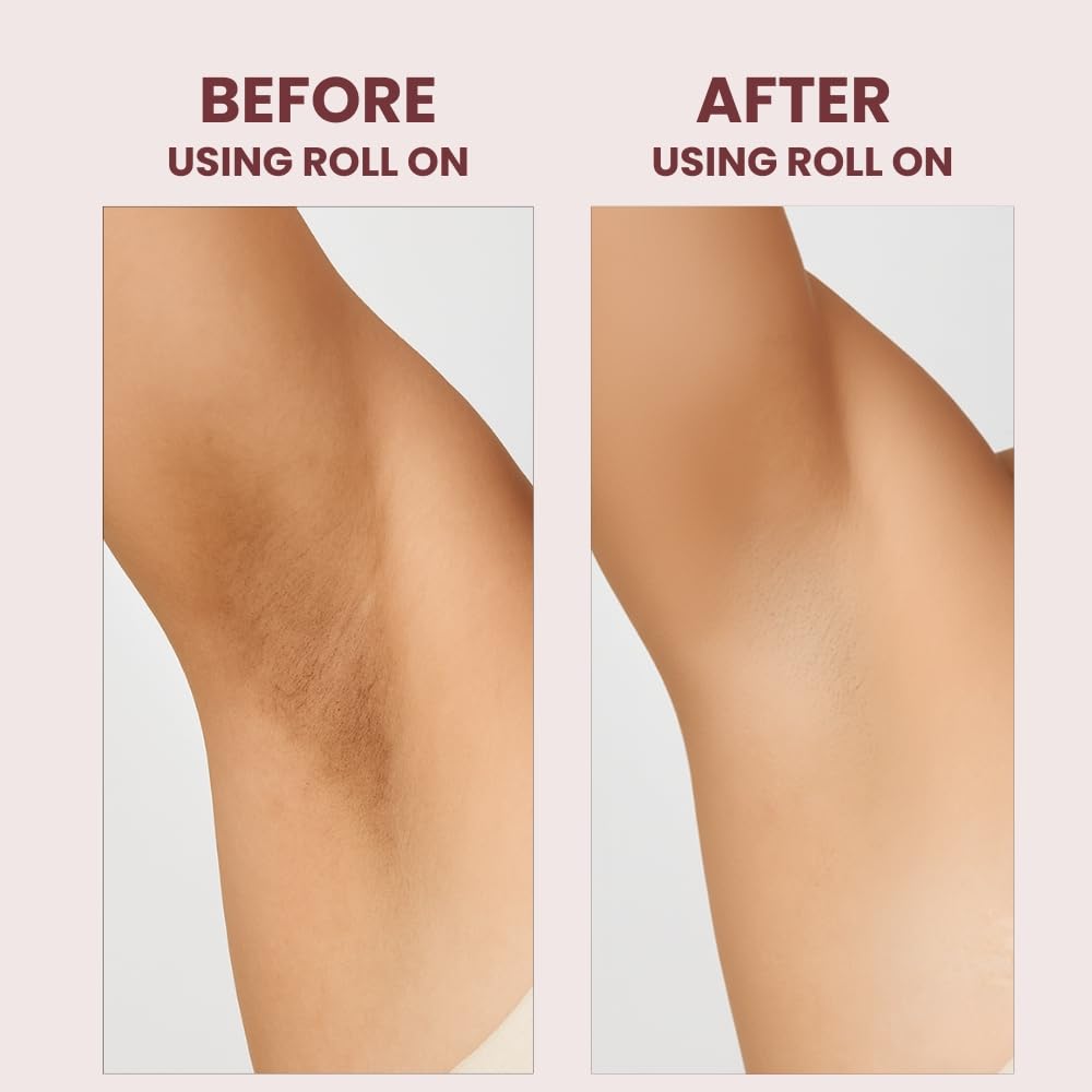 6% AHA BHA Underarm Roll On – Fades Pigmentation & Controls Body Odour