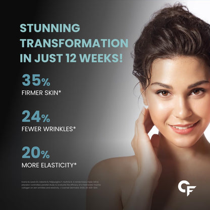 Carbamide Forte Collagen Supplements | Hydrolyzed Collagen Powder for Women & Men | Hydrolyzed Peptides Powder - Unflavored - Collagen Supplements for Skin & Hair - 200g