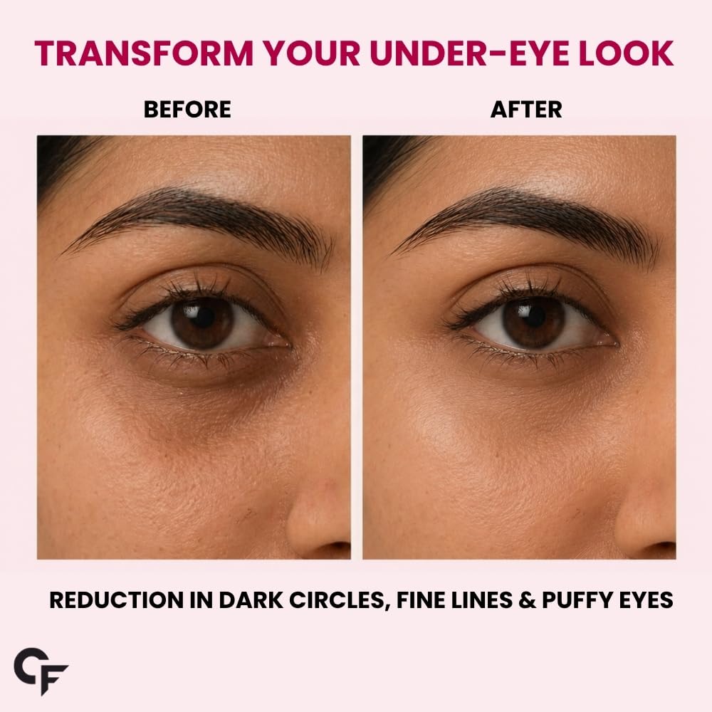 Hydrogel Under Eye Patches for Dark Circles & Puffiness - 60 Patches (30 Pairs)