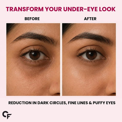 Hydrogel Under Eye Patches for Dark Circles & Puffiness - 60 Patches (30 Pairs)