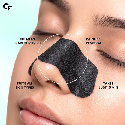 Charcoal Nose Strips for Blackhead Removal - 10 N Strips
