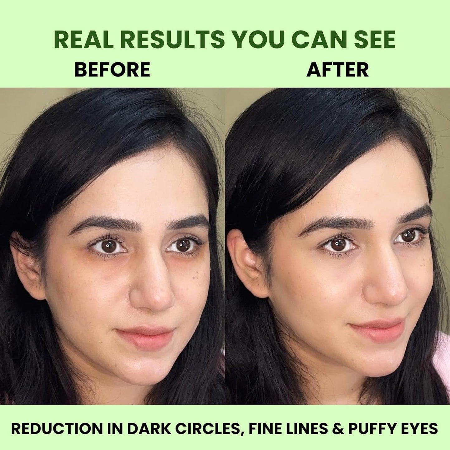 Hydrogel Under Eye Patches – Reduces Dark Circles, Puffiness & Fine Lines