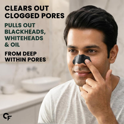 Charcoal Nose Strips for Blackhead Removal - 10 N Strips