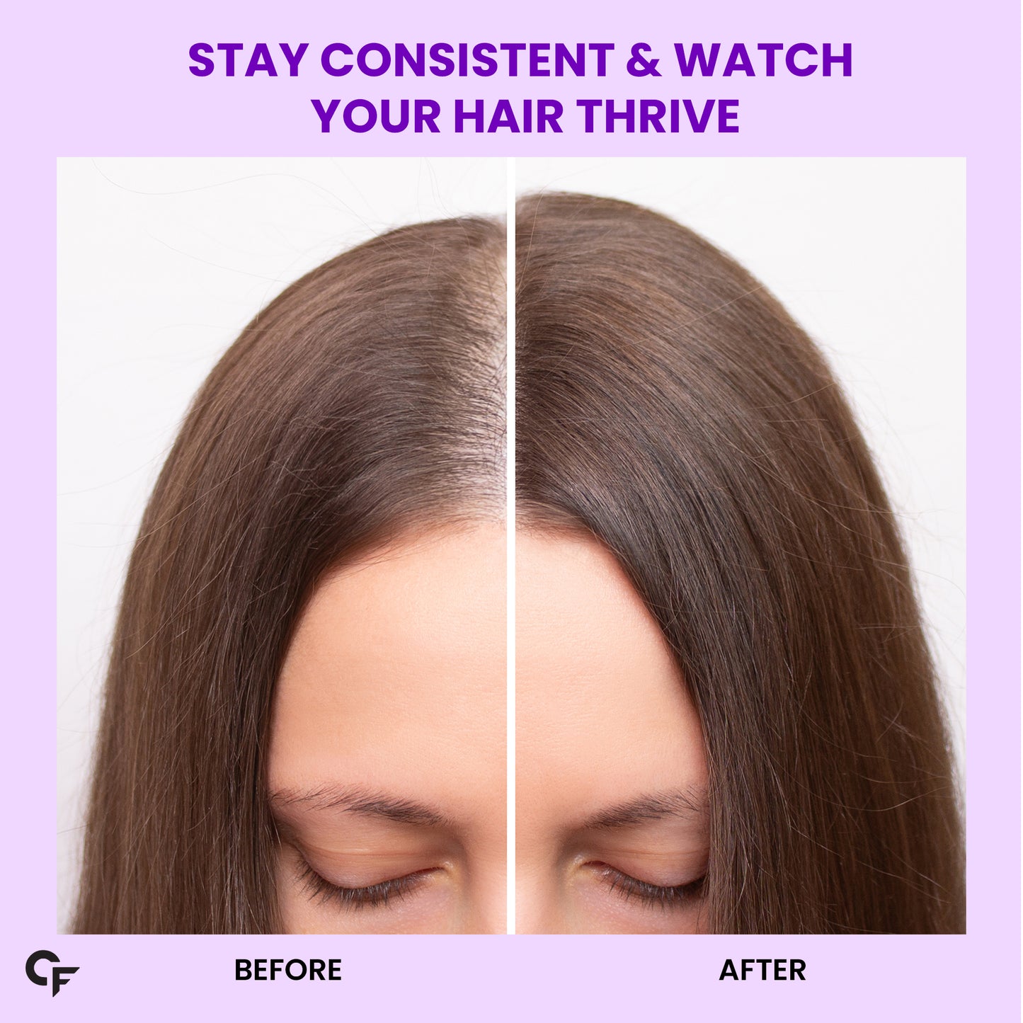 Biotin Tablets for Hair Growth – Hair, Skin & Nail Support