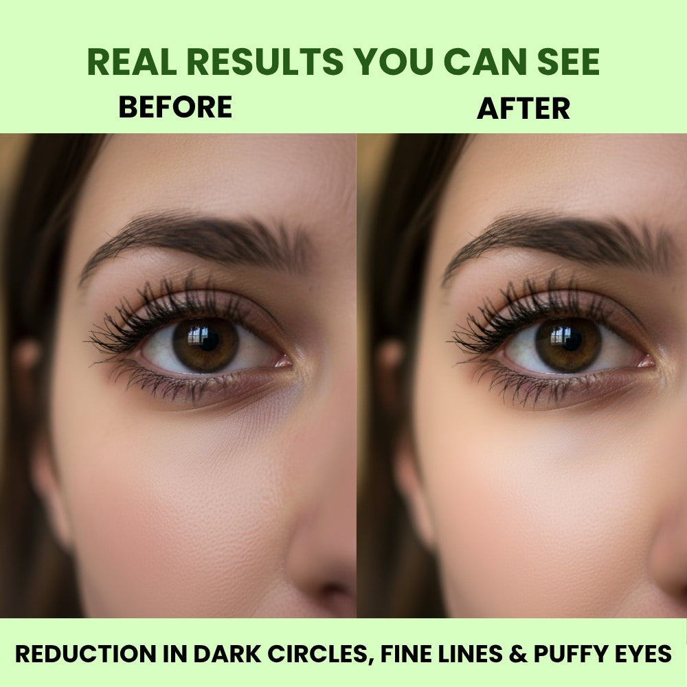 Hydrogel Under Eye Patches – Reduces Dark Circles, Puffiness & Fine Lines