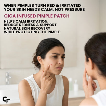 Hydrocolloid Pimple Patches with Salicylic Acid & Cica | 72 Patches