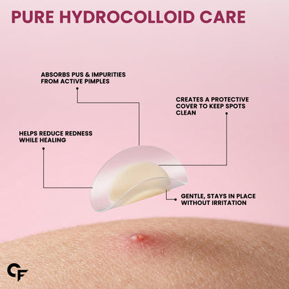 Hydrocolloid Pimple Patches with Salicylic Acid & Cica | 72 Patches