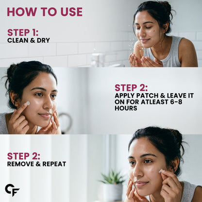 Hydrocolloid Pimple Patches with Salicylic Acid & Cica | 72 Patches