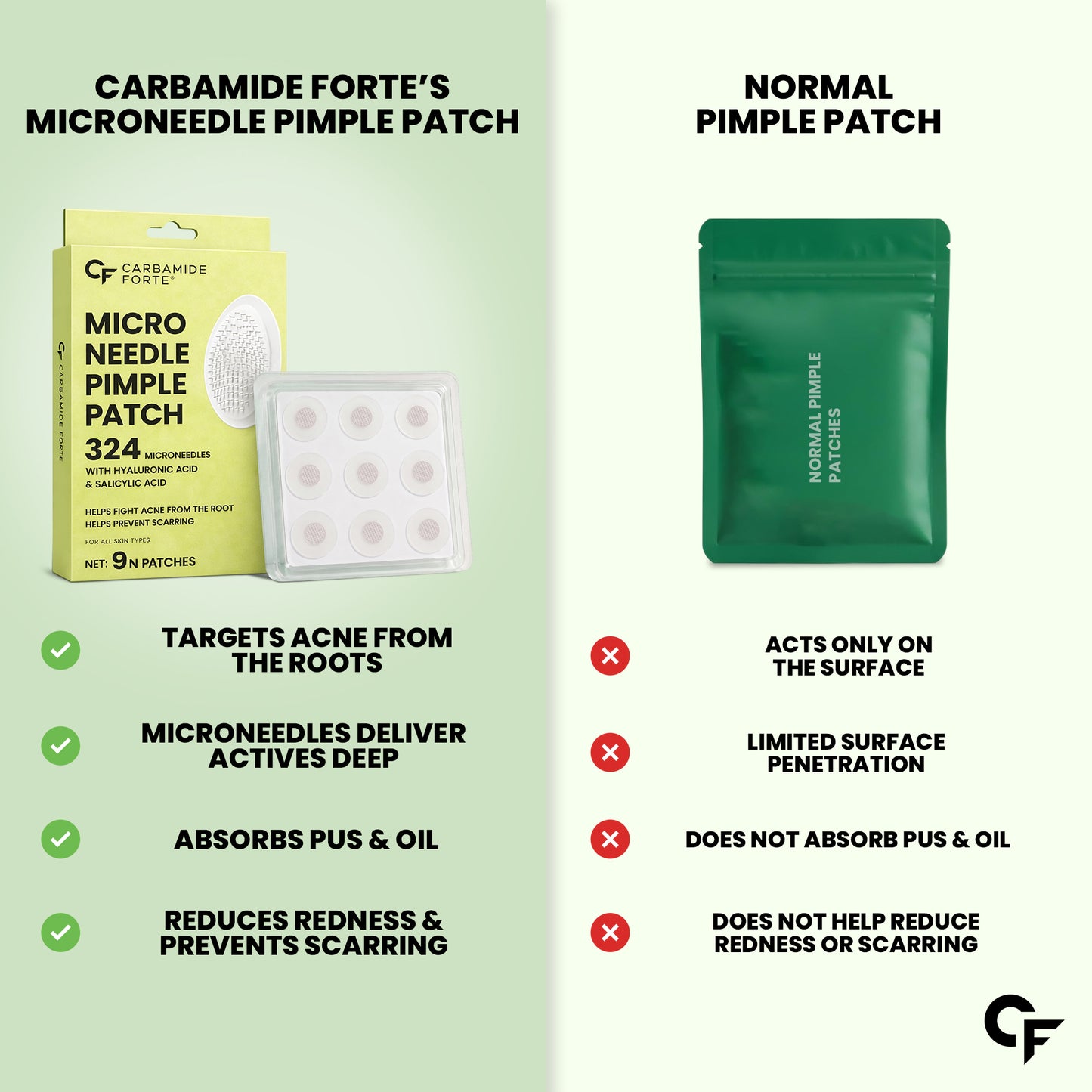 Microneedle Pimple Patches with Salicylic Acid - 9N Patches