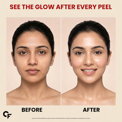 Collagen Peel Off Mask for Glass Skin with Hyaluronic Acid & Niacinamide - 100ml